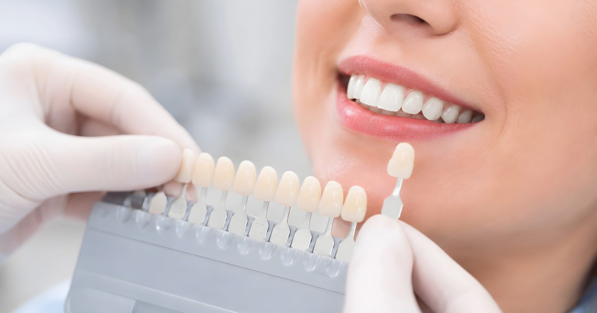 A person smiling with different shades of teeth