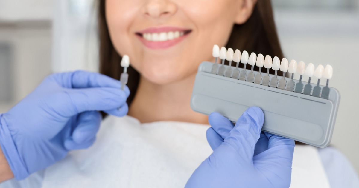 A woman with different shades of teeth whitening in front of her